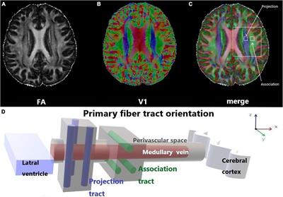 Evaluation of the Glymphatic System With Diffusion Tensor Imaging-Along the Perivascular Space in Cancer Pain
